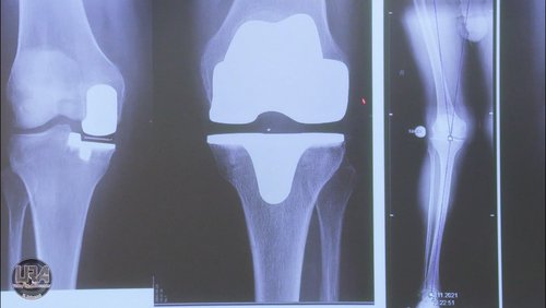 Dr. Bernd Stuckmann, Orthopäde und Chefarzt aus Hagen